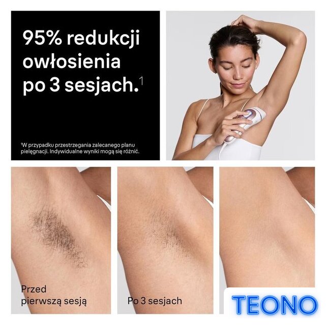Фотоэпилятор Braun Skin i-expert Pro IPL PL7432 - Изображение №9 — Интернет-магазин Teono.by