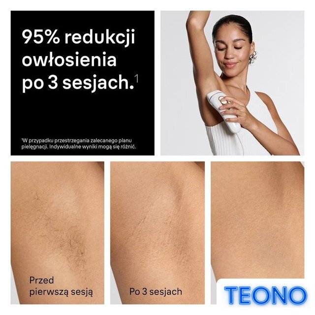 Фотоэпилятор Braun Silk-expert Pro 5 PL5351 - Изображение №5 — Интернет-магазин Teono.by