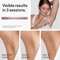 Фотоэпилятор Braun Silk-expert Mini PL1100 - Превью изображения №4 — Интернет-магазин Teono.by