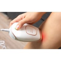 Concept IL3000 IPL Perfect Skin Image #4