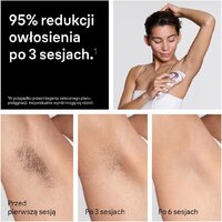 Фотоэпилятор Braun Skin i-expert Pro IPL PL7432 - Превью изображения №9 — Интернет-магазин Teono.by