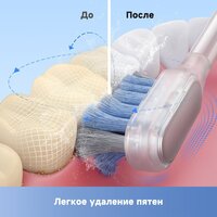 Электрическая зубная щетка Trouver 3D Clean Electric Toothbrush ATB15A (черный) - Превью изображения №9 — Интернет-магазин Teono.by